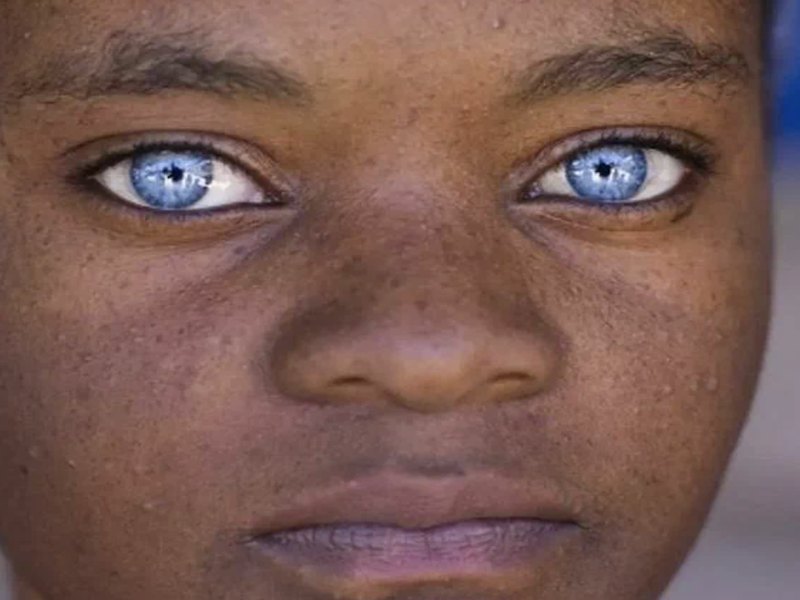 Eye Color Means An Indigo From Sirius B